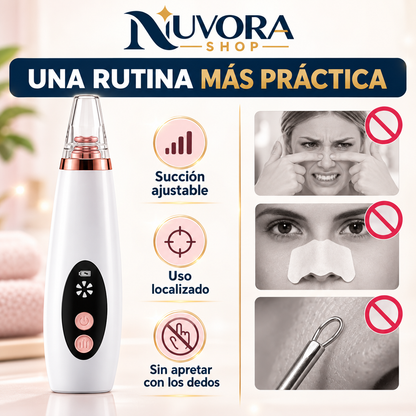 extractor de espinillas y puntos negros